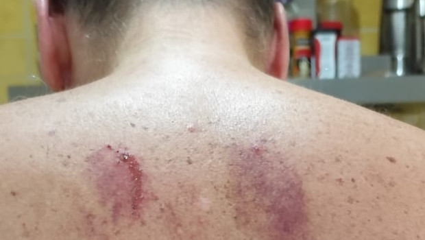 Francisco sufrió varios golpes y magulladuras como consecuencia del impacto, pero las heridas que más duelen son otras