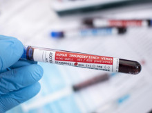 Muestra de sangre infectada con VIH