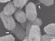 Superbacterias atrapadas en el acto de transferir un plásmido de resistencia a antibióticos