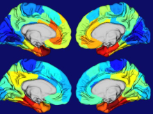 Las áreas rojas y naranjas en estos mapas de calor de cerebros humanos muestran dónde el gen APOE está más activo