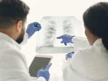 Cáncer de pulmón