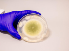 Una muestra de Aspergillus flavus cultivada en el laboratorio Gao. Crédito: Bella Ciervo