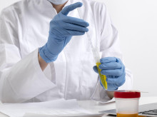 Prueba para detectar el cáncer de colon