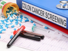 Cáncer de colon