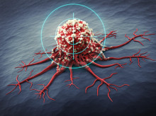 Los fármacos contra el cáncer no siempre cumplen con las expectativas