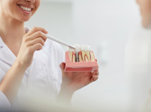 Implantes dentales