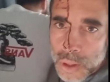 atentado avión de FlyDubai