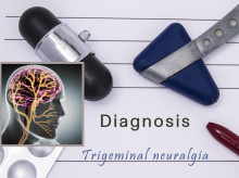 Neuralgia de trigémino
