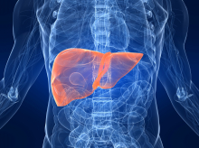 La cirrosis afecta especialmente al hígado y tiene la capacidad de devenir en cáncer
