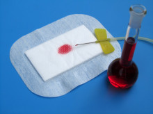 Un chequeo rutinario incluye una analítica de sangre