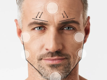 Masculinizacion facial
