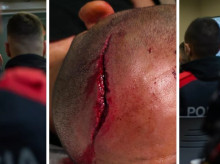 Fractura en la cabeza de uno de los seis agentes heridos