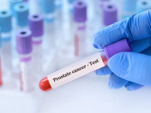 Una uróloga advierte de que el dolor óseo en hombres mayores es una "señal silenciosa" de cáncer de próstata metastásico
REMITIDA / HANDOUT por RUBER INTERNACIONAL
Fotografía remitida a medios de comunicación exclusivamente para ilustrar la noticia a la que hace referencia la imagen, y citando la procedencia de la imagen en la firma
11/6/2025