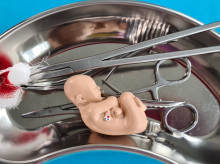 Aborto