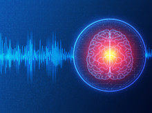 Cerebro
