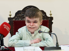 El pequeño Leo, con la enfermedad pie de mariposa