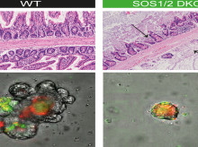Los investigadores han concluido que el intestino es una barrera contra el paso de las bacterias a la sangre