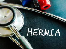 Hernias inguinales