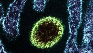 Un henipavirus, a vista de microscopio