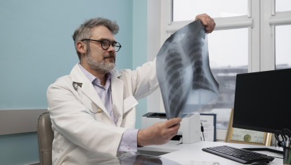 Oncólogo revisando una radiografía