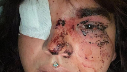 Miss Trans Zamora 2024, tras ser agredida en La Bañeza, según ha denunciado