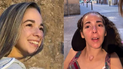 A la izquierda una imagen de Marta antes del shock, y a la derecha en su estado actual