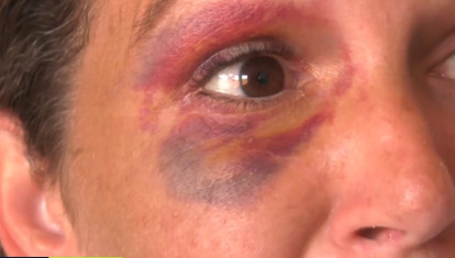 Rostro de Eloísa, la mujer embarazada que sufrió una paliza por parte de unos okupas