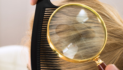 Ozempic puede estar relacionado con la caída del cabello