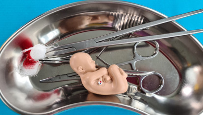 Concepto de aborto con feto bebé y herramienta médica