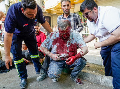 Un hombre herido en un supuesto ataque israelí en el bulevar Keshavarz, en el centro de Teherán