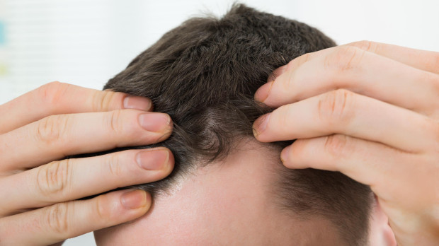 MAN CHECKING HAIRLINE AT HOME.LOSE,LOSING,LOOSING,LOSS,TEST,CHECKING,TESTING,SAMPLE,HAIR,HEAD,CARE,HUMANS,HUMAN BEINGS,PEOPLE,FOLK,PERSONS,HUMAN,HUMAN BEING,LOSE,LOSING,LOOSING,MEN,MAN,HAND,CLOSEUP,MALE,MASCULINE,SKIN,PERSON,LOSS,WELLBEING,LOOK,GLANCING,SEE,VIEW,LOOKING,PEEKING,LOOKING AT,SMALL,TINY,LITTLE,SHORT,ADULT,ONE,COMPANY,CONCERN,CORPORATION,MORNING,HIGH,TEST,CHECKING,TESTING,SAMPLE,PROBLEM,ADULTS,TOP,HAIRLINE,BALDNESS,TALL,HAIR,HEAD,TOMORROW,ANGLE,CARE,HOME,DANDRUFF,HAIRLOSS,DANDRUFF,HAIRLOSS,EXAMINING,SCRUTINY,TOUCHING,30S,INDOORS,ALOPECIA,RECEDING,MID,TRICHOLOGY
