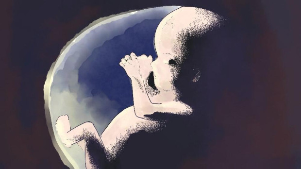 Ilustración: leyes del aborto