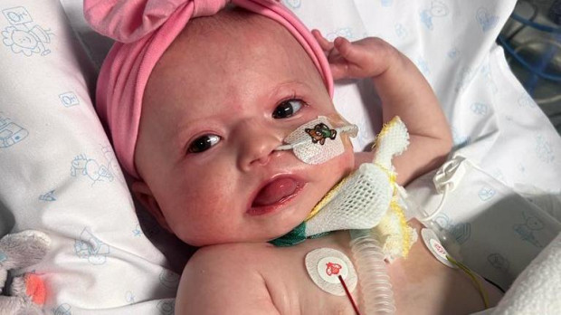 Judith es una pequeña de ocho meses con el síndrome de Odine