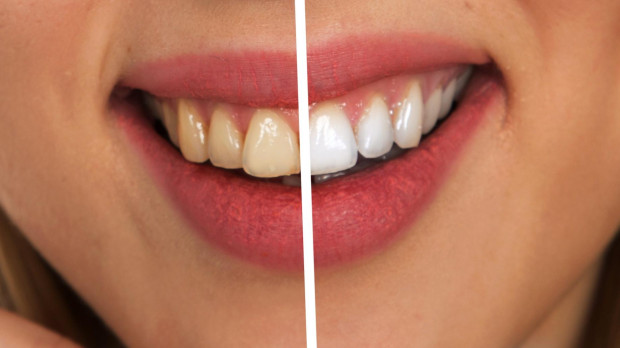Cada vez hay más productos que aseguran que podemos ganar tonos de blancura en nuestros dientes