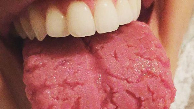 Lengua agrietada