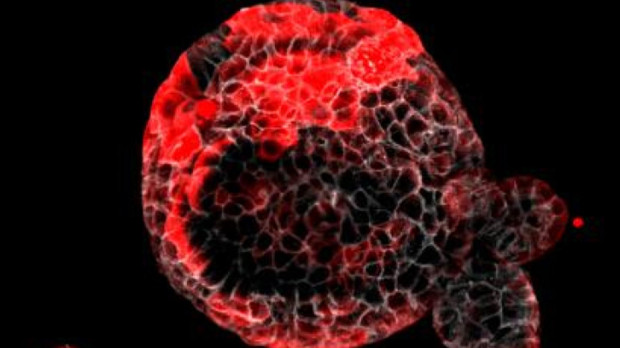 Organoide de cáncer colorrectal con las células residuales responsables de la recaída en rojo.