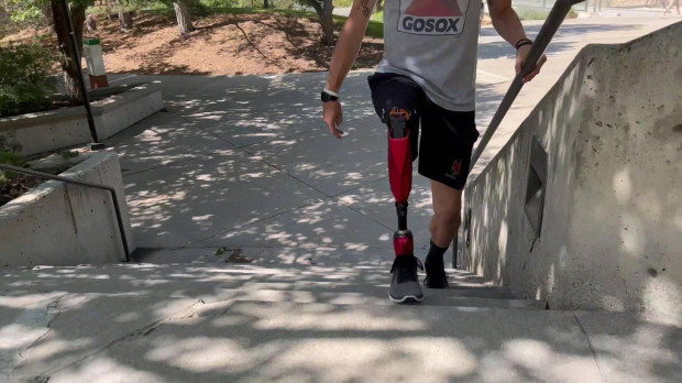 Persona amputada usando la prótesis robótica de la Universidad de Utah