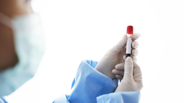 Doctor sosteniendo un tubo de ensayo de sangre