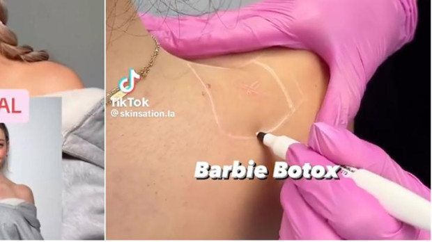 Isabelle Lux, la mujer que asegura haber popularizado el 'Barbie Bótox'