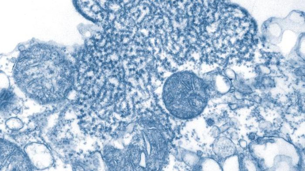 virus Nipah