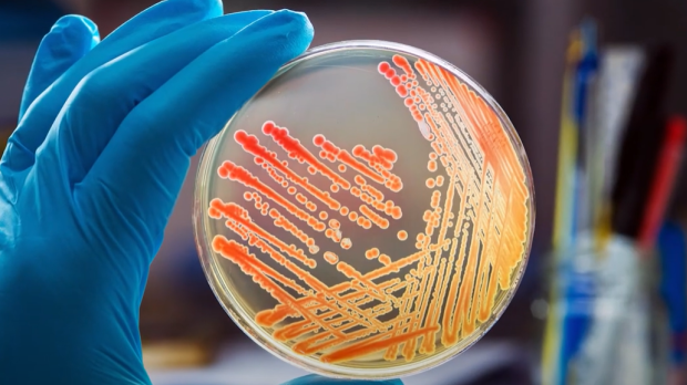 Bacterias