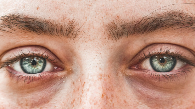 Una caída excesiva del vello de las cejas se puede deber a múltiples causas