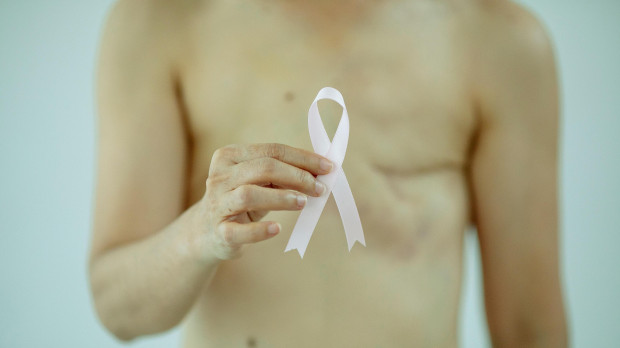 Mujer operada de cáncer de mama