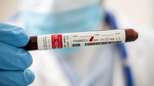 Un hombre sigue aislado al dar positivo por coronavirus 78 veces
