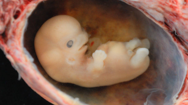 Un embrión humano, aproximadamente a las 8 semanas de gestación.
