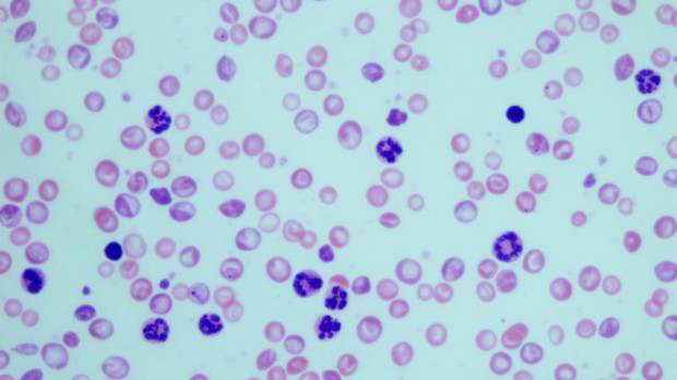 Granulocitos en muestras sanguíneas de ratones con leucemia mielogénica crónica