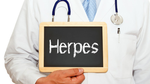 Herpes