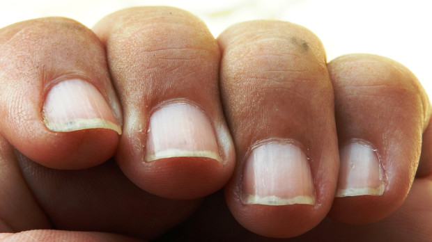 Las uñas son un chivato del estado de salud