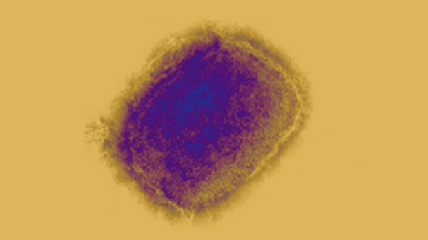 Virus de la viruela del mono