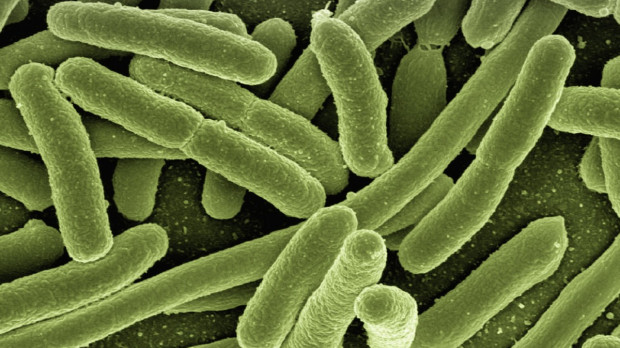 E. coli, un tipo de bacteria